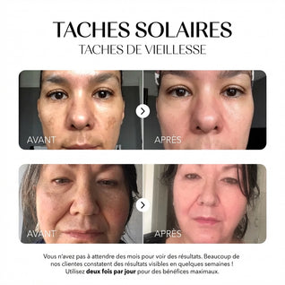 Rosyra Sérum Anti-Taches