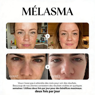 Rosyra Sérum Anti-Taches