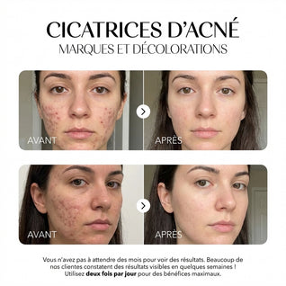 Rosyra Sérum Anti-Taches